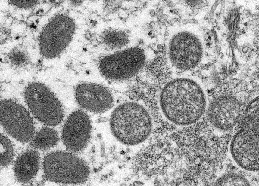 Die WHO muss erneut prüfen, ob der Ausbruch der Affenpocken ein Gesundheitsnotfall von internationaler Tragweite ist