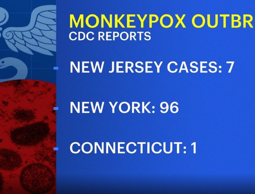 Gesundheitsbeamte bestätigen ersten Fall von Affenpocken in Camden County;  Vollzustand bei 7