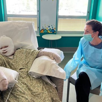 Wissenschaftliches Experiment schief gelaufen;  Junge, der sich in einem örtlichen Behandlungszentrum für Verbrennungen erholt