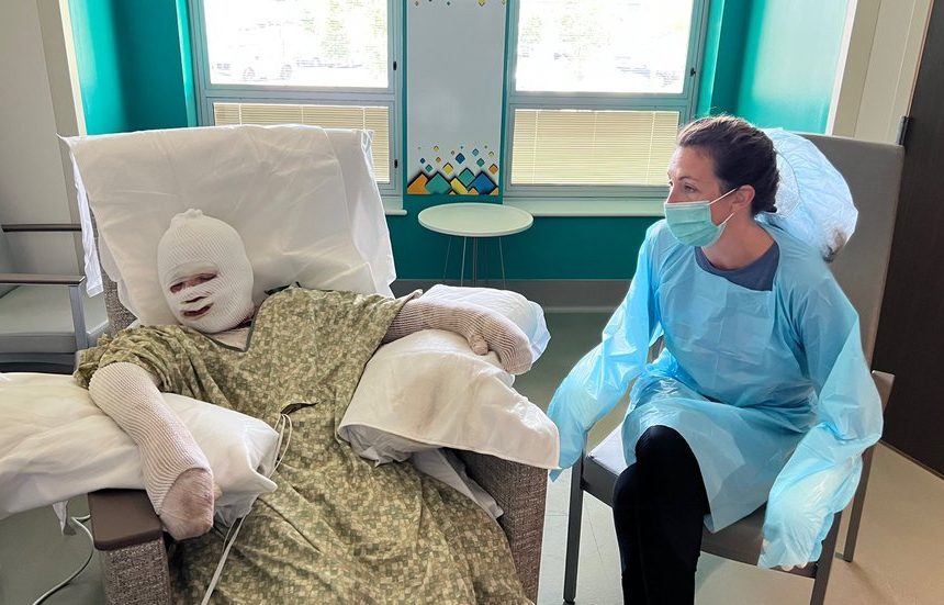 Wissenschaftliches Experiment schief gelaufen;  Junge, der sich in einem örtlichen Behandlungszentrum für Verbrennungen erholt