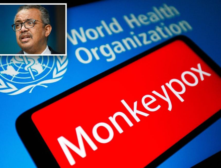 Laut WHO sind Affenpocken derzeit keine ernsthafte Bedrohung