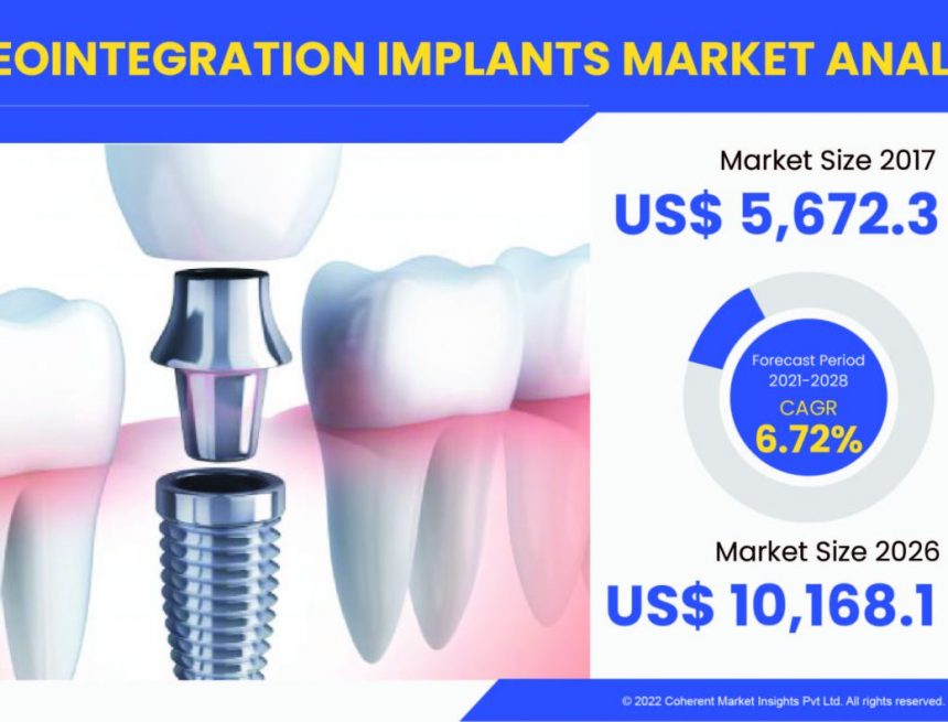 Erfahren Sie, warum der globale Markt für Osseointegrationsimplantate mit aktuellen und zukünftigen Geschäftsmöglichkeiten schnell wächst |  Abgedeckte Schlüsselunternehmen – Medtronic, Stryker Corporation, Zimmer Biomet Holdings, Smith and Nephew